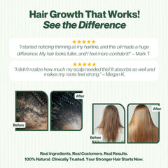 Hair Growth Oil